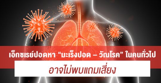 เอ็กซเรย์ปอดหา “มะเร็งปอด – วัณโรค” ในคนทั่วไปอาจไม่พบแถมเสี่ยง