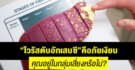 “ไวรัสตับอักเสบซี” คือภัยเงียบ…คุณอยู่ในกลุ่มเสี่ยงหรือไม่?