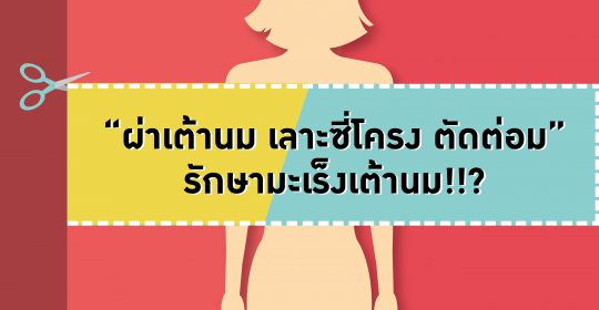 ย้อนบทเรียน “ผ่าเต้านม เลาะซี่โครง ตัดต่อมน้ำเหลือง” เพื่อรักษามะเร็งเต้านม